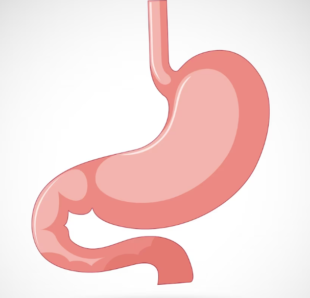 Can GLP1 receptor agonists cause gastroparesis, and can it be permanent?
