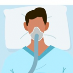 How much does sleep apnea improve with weight loss – and does it matter how the weight is lost?