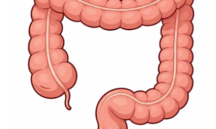 Do GLP1 medications impact colon cancer risk?